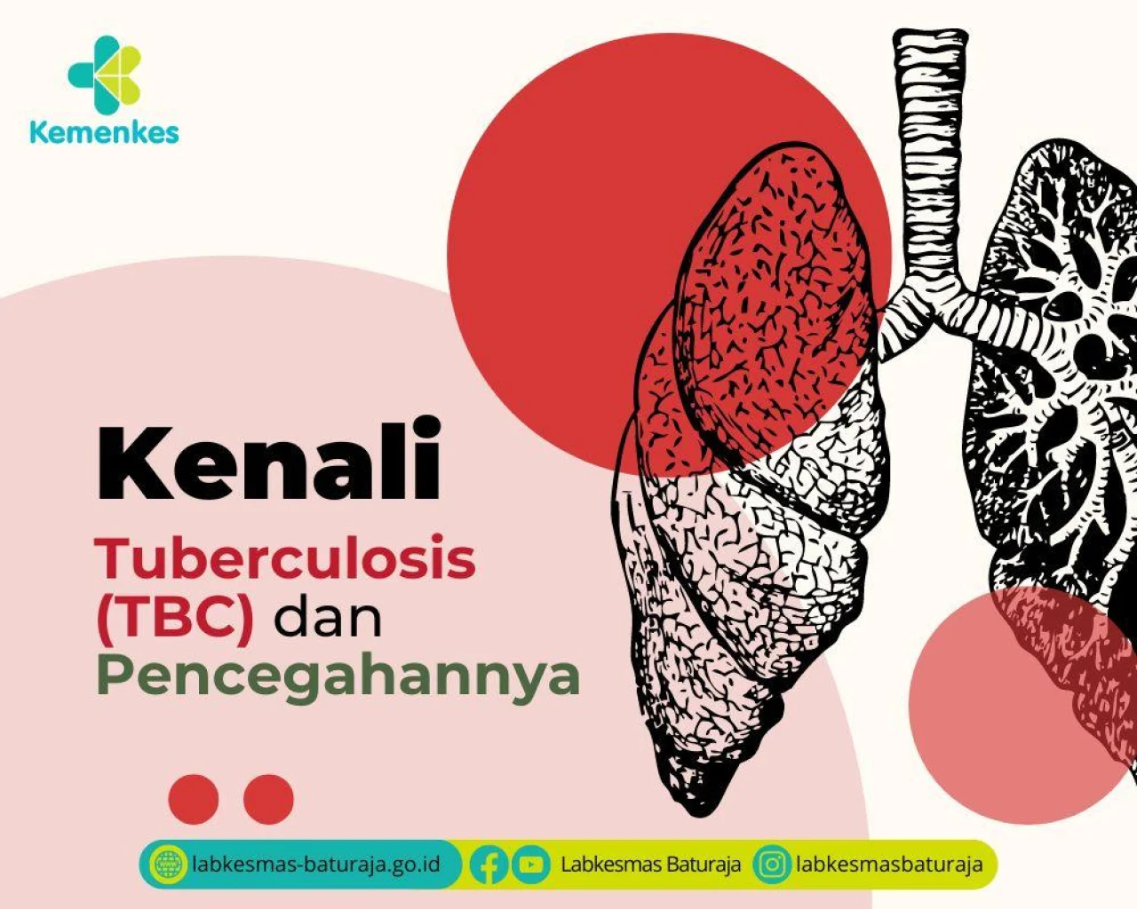 Kematian Tiap 4 Menit Dorong Wamenkes Tekankan Urgensi Deteksi TBC yang Belum Teridentifikasi