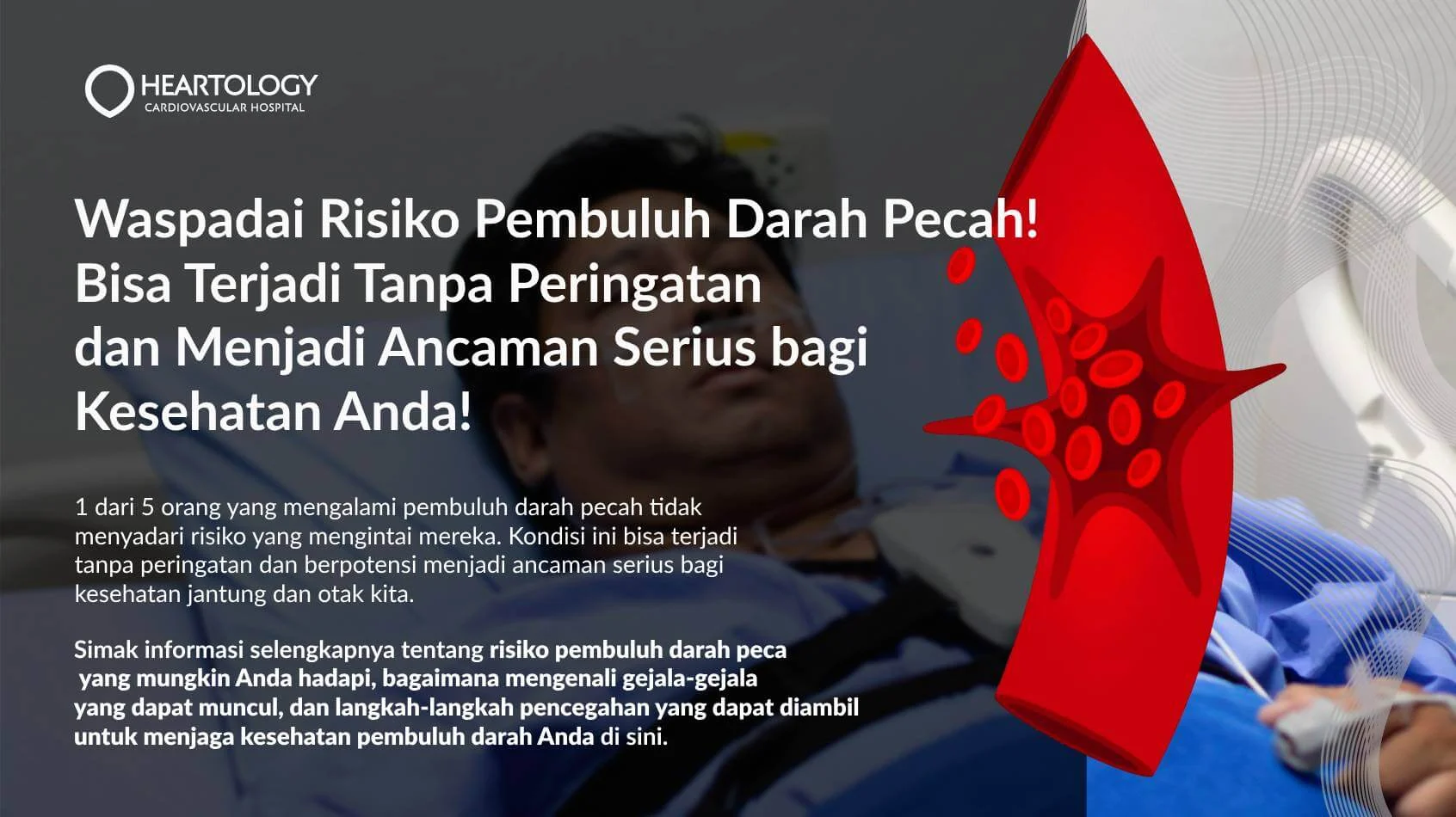 Kesehatan Noel Memburuk Pasca Sidang: Dokter Curiga Gangguan Pembuluh Darah Otak