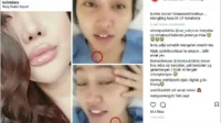 Lucinta Luna Ungkap Realita Pahit Pasca Operasi Kelamin: Tidak Bisa Miliki Anak Kandung