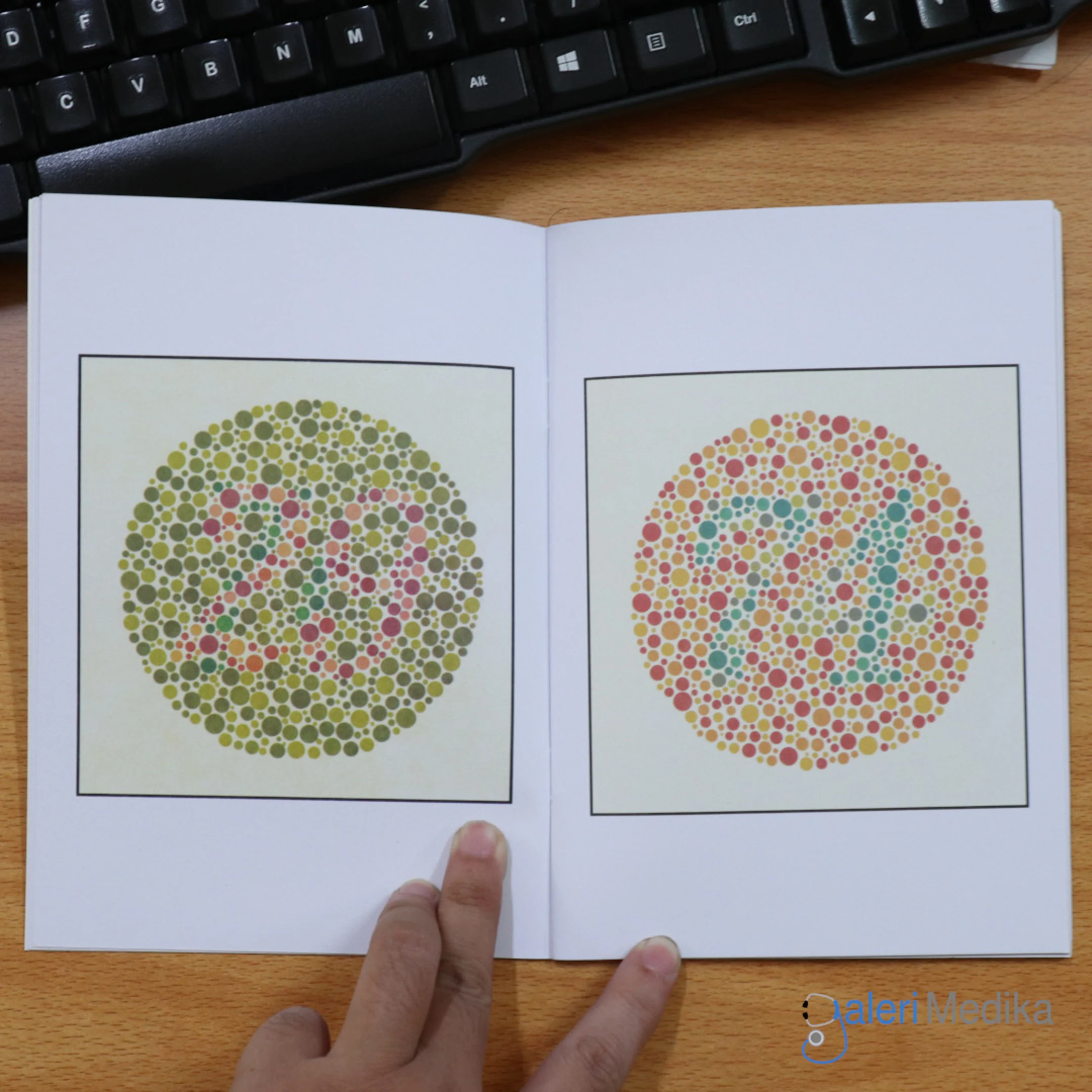 Uji Penglihatan Warna lewat Tes Ishihara: Kunci Lulus SIM dan Mengenali Buah dalam Gambar