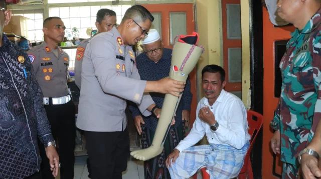 Korban Serangan Buaya di Gowa Terima Kaki Palsu dari Kemensos, Harapan Baru untuk Hidup Mandiri